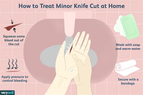 How To Treat Accidental Knife Cuts In The Kitchen
