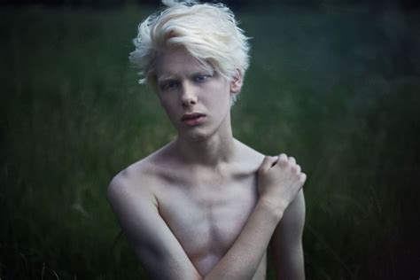 Albino Man Albino Men Albino Human Albino Model