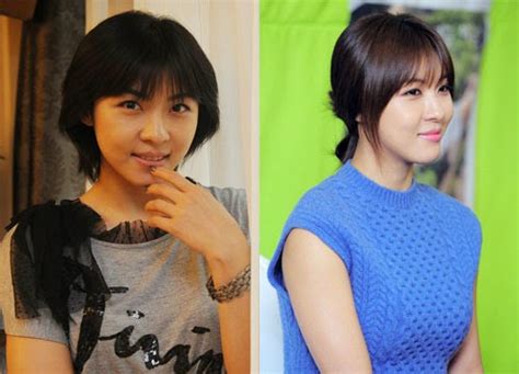 Ha Ji Won Plastic Surgery Before And After Foto Bugil Bokep