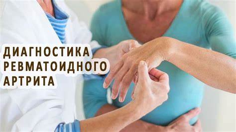Диагностика ревматоидного артрита - YouTube Картинка - Диагностика ревматоидного артрита - YouTube