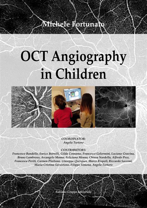 Oct Angiography In Children Fabiano Gruppo Editore