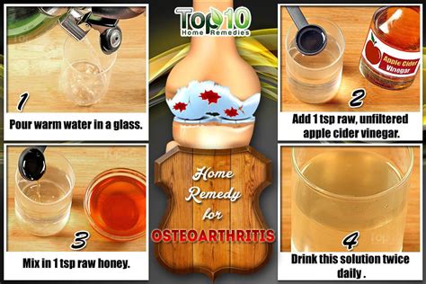 Home Remedies For Osteoarthritis Top 10 Home Remedies