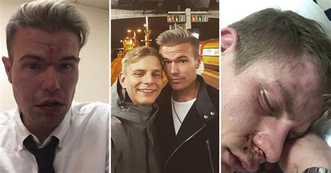 Gay Couple Beaten Up In Homophobic Attack On Busy Train Metro News