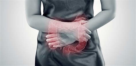 What Is Ulcerative Colitis Causes Signs And Symptoms