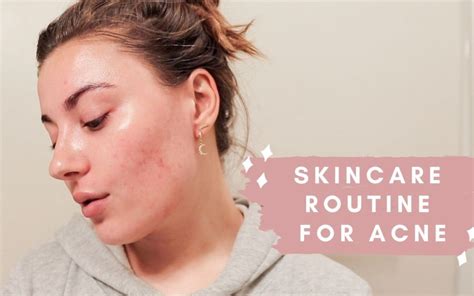 Acne And Clogged Pores Skincare Routine Feb 2020 Emily Freybler Morning