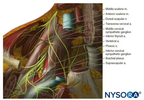 Supraclavicular Brachial Plexus Block Landmarks And Nerve Stimulator