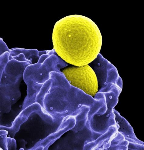 Oklahoma Researchers Develop New Mrsa Antiiobiotic Treatment Outbreak