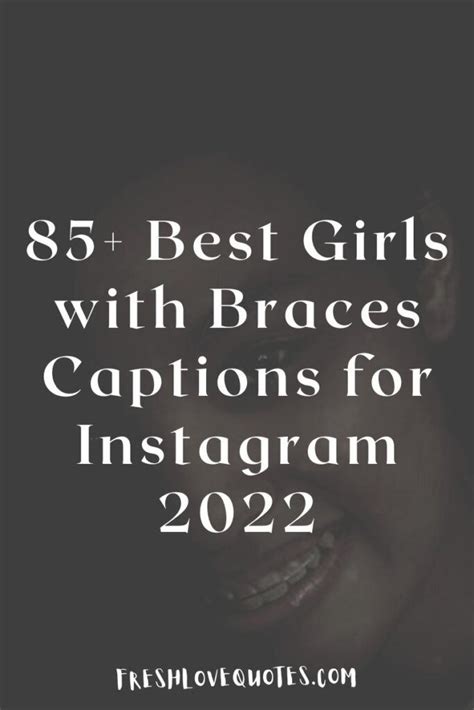 Best Girls With Braces Captions For Instagram Artofit