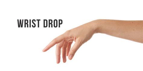 Wrist Drop Treatment, Causes Symptoms | Physiotherapy Hospital