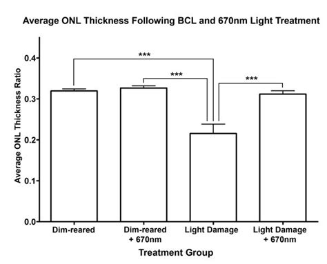 670 Nm Light Treatment Reduces Complement Propagation Following Retinal