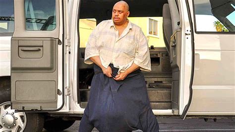 Tv Special Documents ‘man With The 132 Pound Scrotum’ Fox News