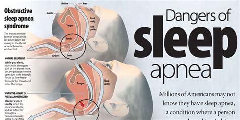 Mediterranean Diet Can Help Ease Sleep Apnea Symptoms