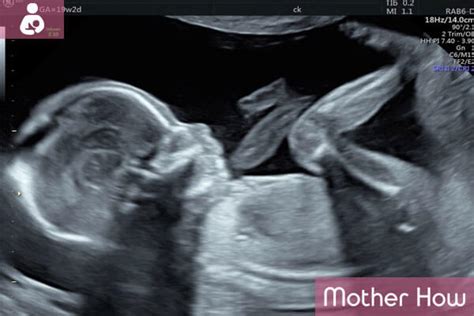19 Weeks Pregnant Symptoms Ultrasound Fetus Development Motherhow