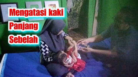 Mengatasi Kaki Panjang Sebelah Youtube