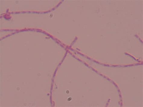 Has Anyone Seen This Filamentous Bacteria In Activated Sludge