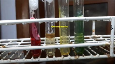 Gram Negative Bacteria Biochemical Test Table Introduction Com
