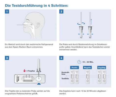 Serological test, serology, blood test, serology test. Roche SARS-CoV-2 Rapid Antigen Test Quick Test da 25 pezzi ...