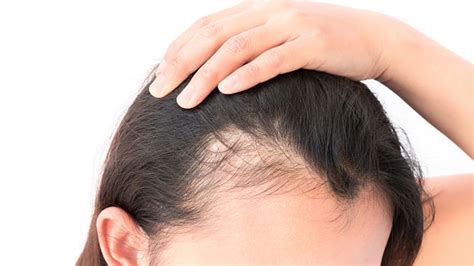 How Can Clinicians Differentiate Scarring Vs Non Scarring Alopecia