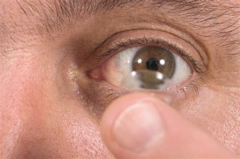 FDA Approves First Contact Lens That Slows Myopia Progression UPI Com