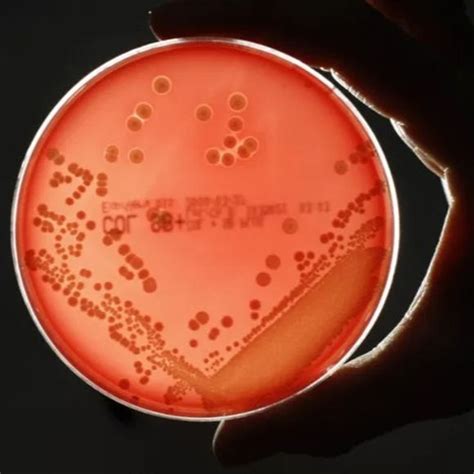 Superbugs Could Kill 10 Million People Annually Cost 100 Trillion By