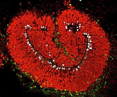 Cell Press On Instagram “organoid Smile A Ventricle Of A Human