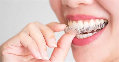 Advantages And Disadvantages Of Clear Aligners Zenit Dent