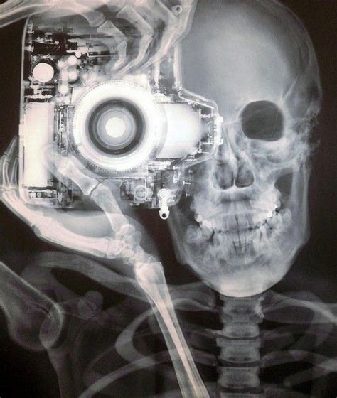 Radiologi Fotografer Tengkorak