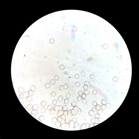 White Blood Cells Under Microscope Labeled
