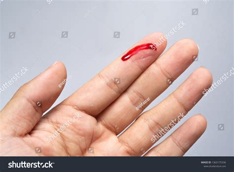 Bleeding Blood From The Cut Finger Wound Royalty Free Stock Photo