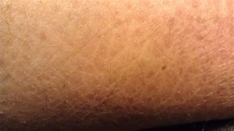 10 Ways To Get Rid Of Dry Skin On Leg Howhunter