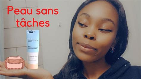 Crèmes Contre Lhyperpigmentation Peau Noire Youtube