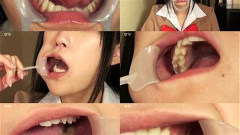 Deviant Dentist Mouth Fetish Mania The Dare Of Mouth And Teeth