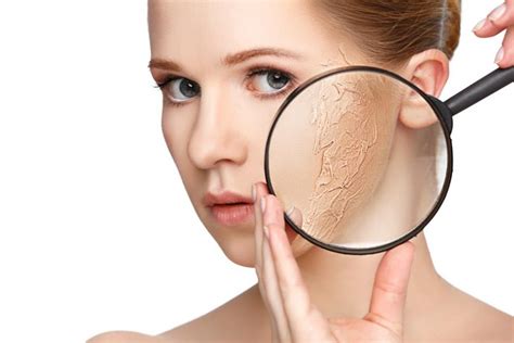 Causes Of Dry Patches On Face And Their Treatment Charlies Magazines