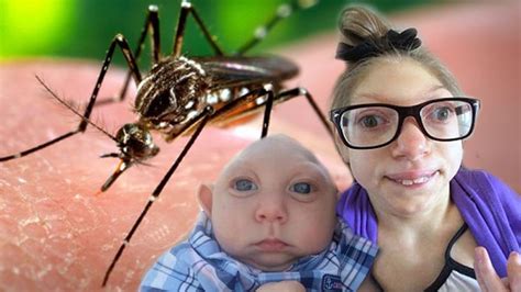 Scientists Discover Why Zika Causes Small Head In Babies Suchablog