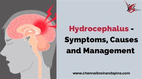 Hydrocephalus Symptoms Causes And Management
