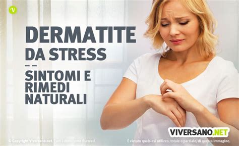 Dermatite Da Stress Cause Sintomi Per Riconoscerla E Rimedi Efficaci