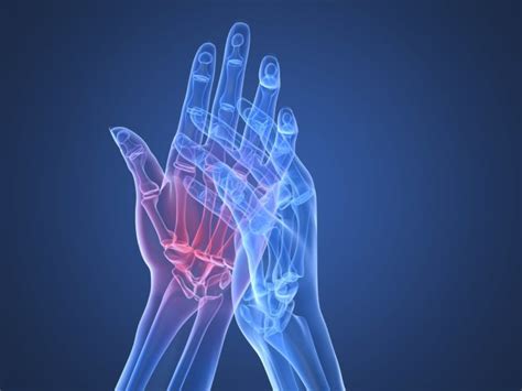 I cibi ricchi di acidi grassi utili sono suddivisi in due gruppi: Baricitinib, il farmaco 2.0 per l'artrite reumatoide ...