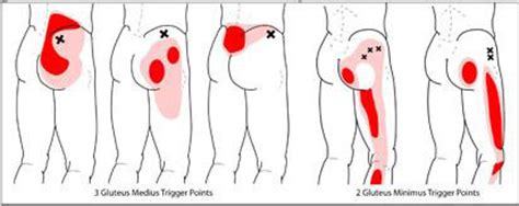 Tight piriformis muscles can lead to knee pain and lower back pain. ILIOPSOAS MUSCLES and QUADRATUS LUMBORUM | John The Bodyman