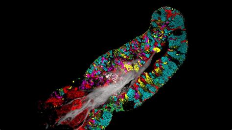 Heres Where Bacteria Live On Your Tongue Cells Science News