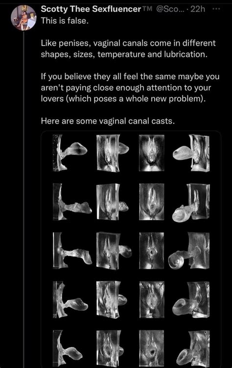 Original Image Of The Different Shapes Of Vagina Without The Random Girls Names Added 🙄 R