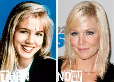 Jennie Garth Plastic Surgery Before And After Plastic Surgery Photos