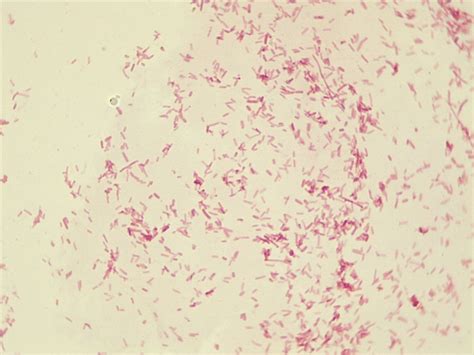 Escherichia Coli Smear Gram Stain Microscopio De Preparaci N X Sexiz Pix