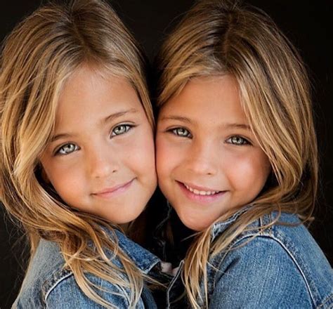 8 Years Ago They Were Called The Most Beautiful Twins In The World