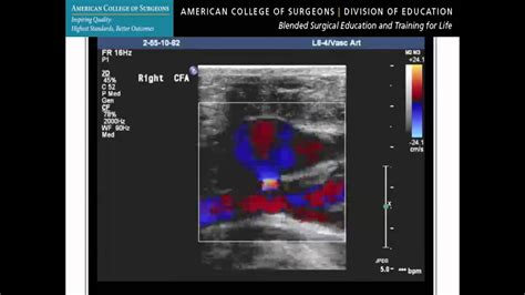 Ultrasound For Surgeons The Basic Course—clinical Example Vascular
