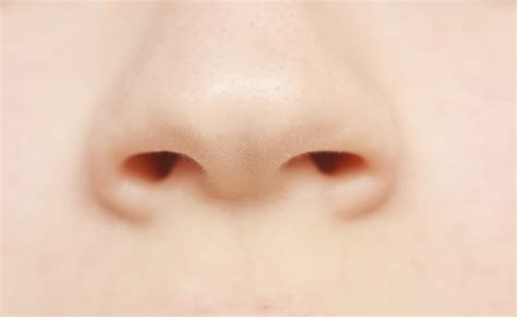 Nose Skin Diseases Skin Diseases Of The Nose