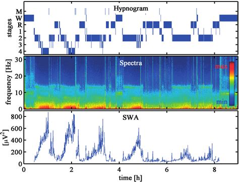 Sleep Profile Top Hypnogram Spectrogram Middle Color Coded Power
