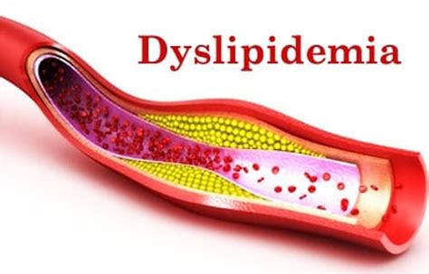 Vadod Dyslipidemia Guidelines Recommend Against Frequent Ldl Testing