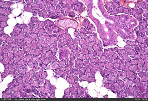 Histology Of Parotid Gland