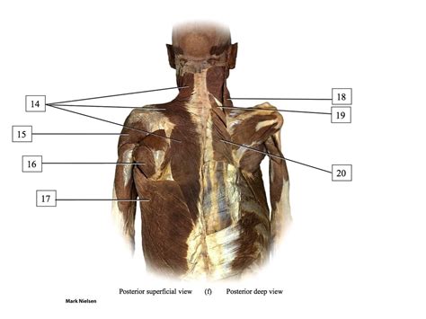 Posterior Superficialdeep View Human Cadaver Practice Diagram Quizlet