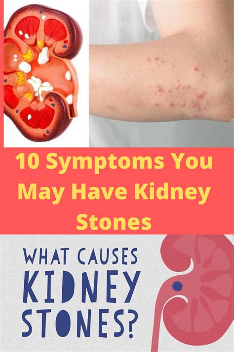 What Causes Kidney Stones In Women